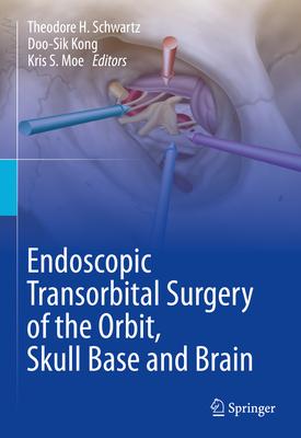 Endoscopic Transorbital Surgery of the Orbit, Skull Base and Brain