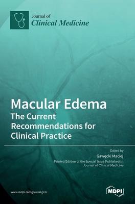 Macular Edema: The Current Recommendations for Clinical Practice