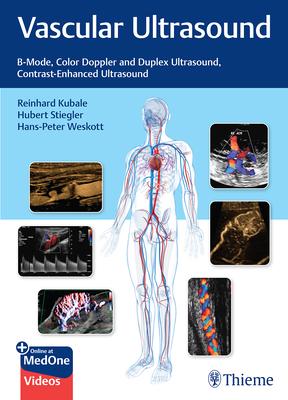 Vascular Ultrasound: B-Mode, Color Doppler and Duplex Ultrasound, Contrast-Enhanced Ultrasound