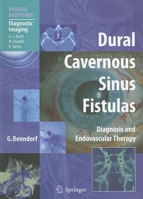 Dural Cavernous Sinus Fistulas: Diagnosis and Endovascular Therapy Subscription
