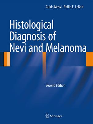 Histological Diagnosis of Nevi and Melanoma