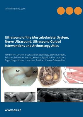 Ultrasound of the Musculoskeletal System, Nerve Ultrasound, Ultrasound Guided Interventions and Arthroscopy Atlas: Musculoskeletal Sonoanatomy Guideli