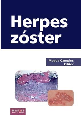 Herpes zster