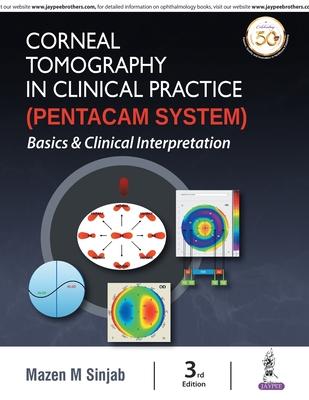 Corneal Tomography in Clinical Practice (Pentacam System): Basics and Clinical Interpretation Subscription