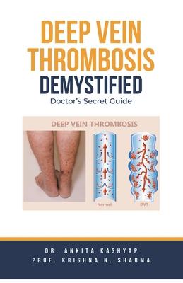 Deep Vein Thrombosis Demystified: Doctor's Secret Guide