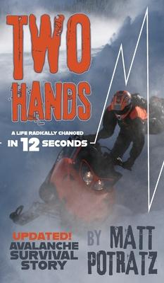 Two Hands: A Life Radically Changed In 12 Seconds