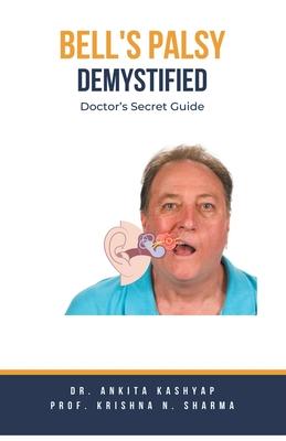 Bell's Palsy Demystified: Doctor's Secret Guide