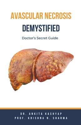 Avascular Necrosis Demystified: Doctor's Secret Guide