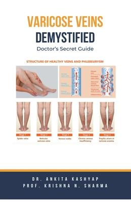 Varicose Veins Demystified: Doctor's Secret Guide