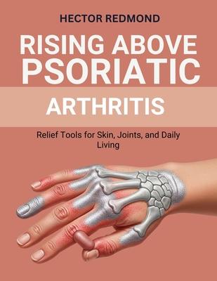 Rising Above Psoriatic Arthritis: Relief Tools for Skin, Joints, and Daily Living