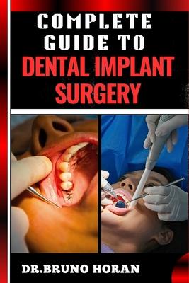 Complete Guide to Dental Implant Surgery: Comprehensive Manual To Advanced Techniques, Recovery, and Best Practices for Optimal Oral Health Subscription