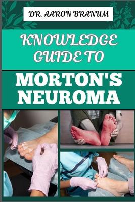 Knowledge Guide to Morton's Neuroma: Essential Manual To Symptoms, Diagnosis, Treatment, And Pain Relief For Foot Health And Nerve Pain Management