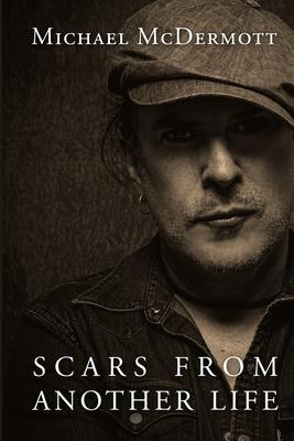 Scars From Another Life: A Memoir