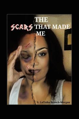 The Scars That Made Me