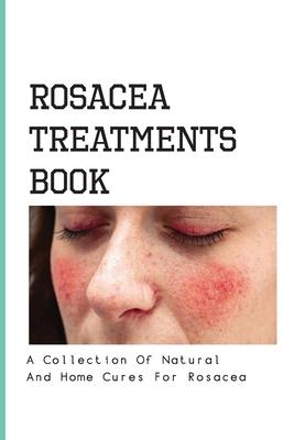 Rosacea Treatments Book- A Collection Of Natural And Home Cures For Rosacea: Rosacea Treatment