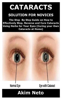 Cataracts Solution for Novices: The Step By Step Guide on How to Effectively Stop, Reverse and Cure Cataracts Using Herbs for Your Eyes (Curing your O