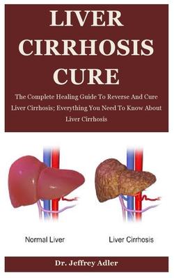 Liver Cirrhosis Cure: The Complete Healing Guide To Reverse And Cure Liver Cirrhosis; Everything You Need To Know About Liver Cirrhosis