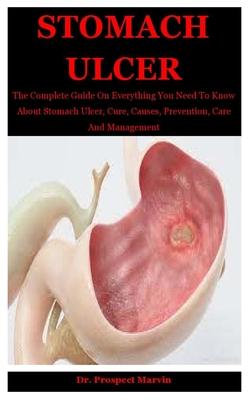 Stomach Ulcer: The Complete Guide On Everything You Need To Know About Stomach Ulcer, Cure, Causes, Prevention, Care And Management