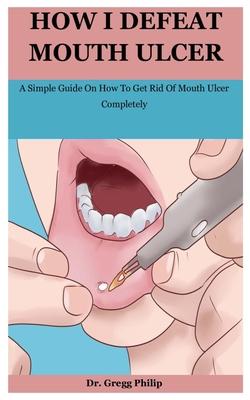 How I Defeat Mouth Ulcer: A Simple Guide On How To Get Rid Of Mouth Ulcer Completely