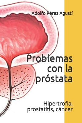 Problemas con la prstata: Hipertrofia, prostatitis, cncer