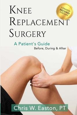 Knee Replacement Surgery, A Patient's Guide: Before, During & After