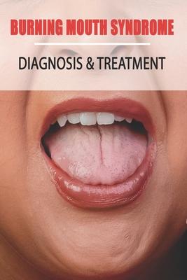 Burning Mouth Syndrome: Diagnosis & Treatment: Burning Mouth Syndrome Guide