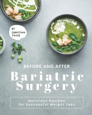 Before and After Bariatric Surgery: Delicious Recipes for Successful Weight Loss Subscription