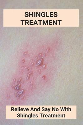 Shingles Treatment: Relieve And Say No With Shingles Treatment: Shingles On Face Treatment