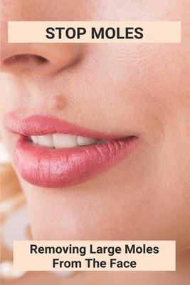 Stop Moles: Removing Large Moles From The Face: Surefire Way To Get Rid Of Moles