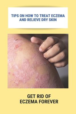 Tips On How To Treat Eczema And Relieve Dry Skin: Get Rid Of Eczema Forever: Overcome Eczema