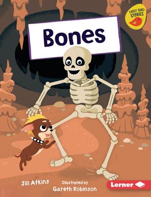 Bones