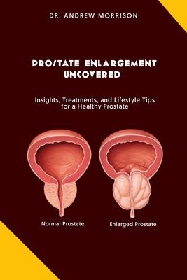 Prostrate Enlargement Uncovered: Insights, Treatments, and Lifestyle Tips for a Healthy Prostate