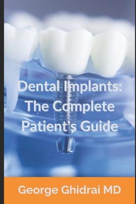 Dental Implants: The Complete Patient's Guide