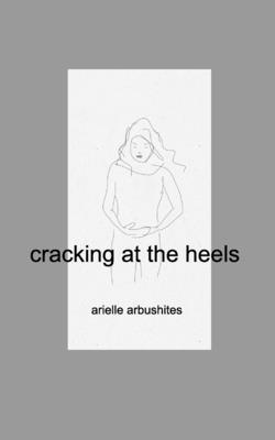 cracking at the heels