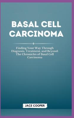 Basal Cell Carcinoma: Finding Your Way Through Diagnosis, Treatment, and Beyond: The Chronicles of Basal Cell Carcinoma