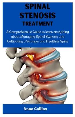 Spinal Stenosis Treatment: A Comprehensive Guide to learn everything about Managing Spinal Stenosis and Cultivating a Stronger and Healthier Spin