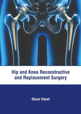 Hip and Knee Reconstructive and Replacement Surgery