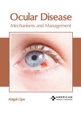 Ocular Disease: Mechanisms and Management