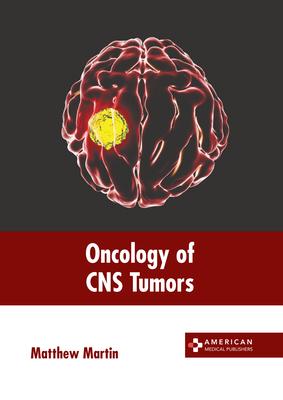 Oncology of CNS Tumors