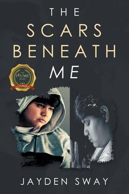 The Scars Beneath Me