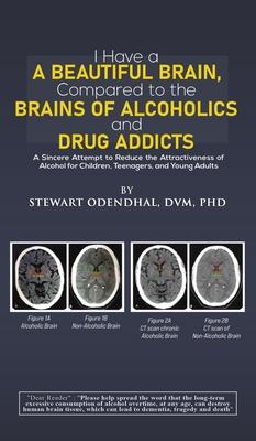 I Have a Beautiful Brain, Compared to the Brains of Alcoholics and Drug Addicts