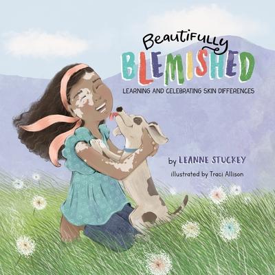 Beautifully Blemished: Learning and Celebrating Skin Differences