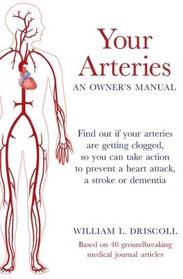 Your Arteries-An Owner's Manual: Find out if your arteries are getting clogged, so you can take action to prevent a heart attack, a stroke or dementia