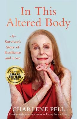 In This Altered Body: A Survivor's Story of Resilience and Love